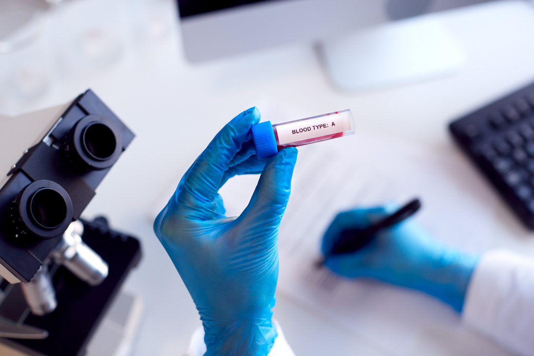 Close up of Lab Worker Conducting Research Using Microscope Holding Blood Sample Labelled Type a